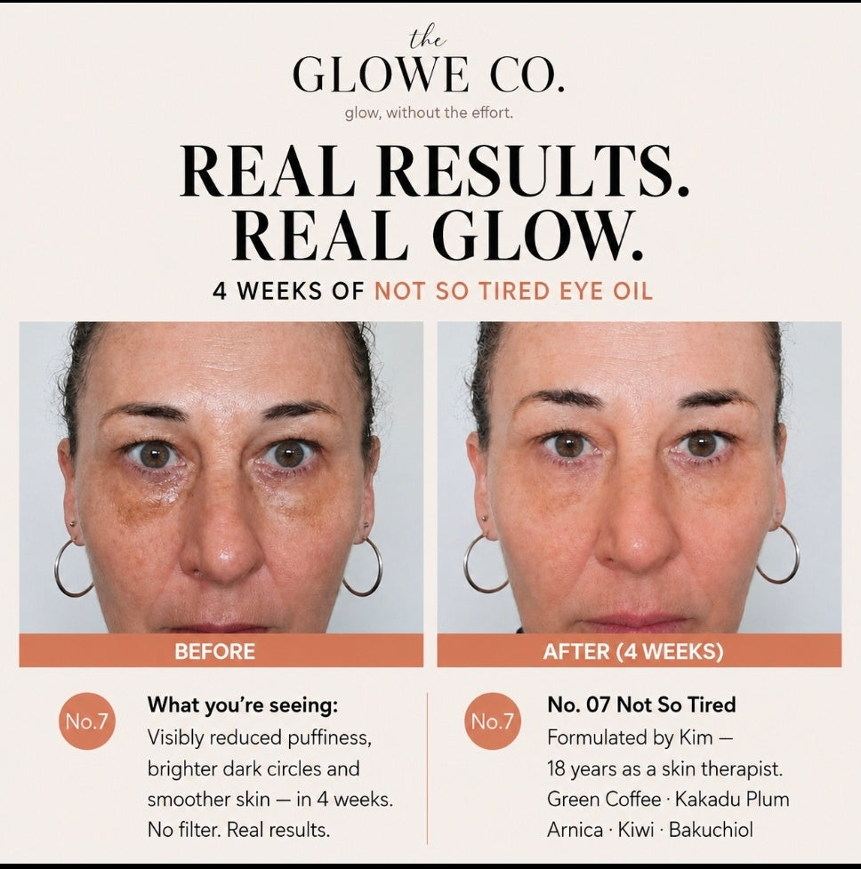 The Glowe Co Not So Tired eye oil roller applied with cooling stainless steel roller ball