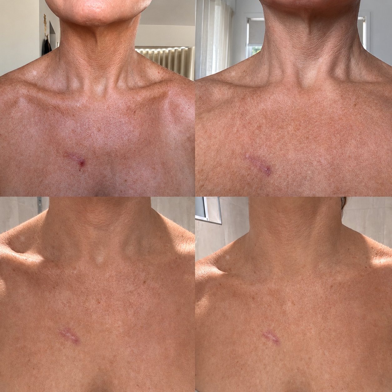 No. 05 The Signature Elixir – neck and décolletage treatment oil detail, The Glowe Co